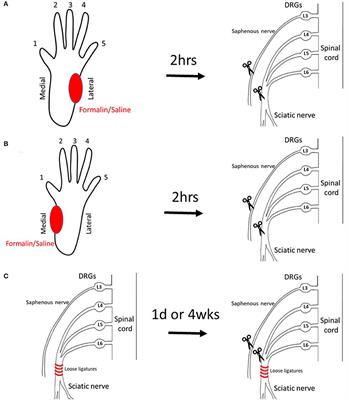 Development of a Phantom Limb Pain Model in Rats: Behavioral and Histochemical Evaluation